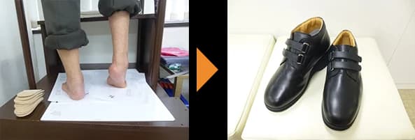 左右の足の状態（左）と、その足に合わせてつくった黒いベルト留めの靴（右）